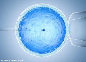 男性不育案例